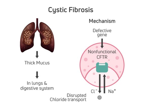 Infograhics2